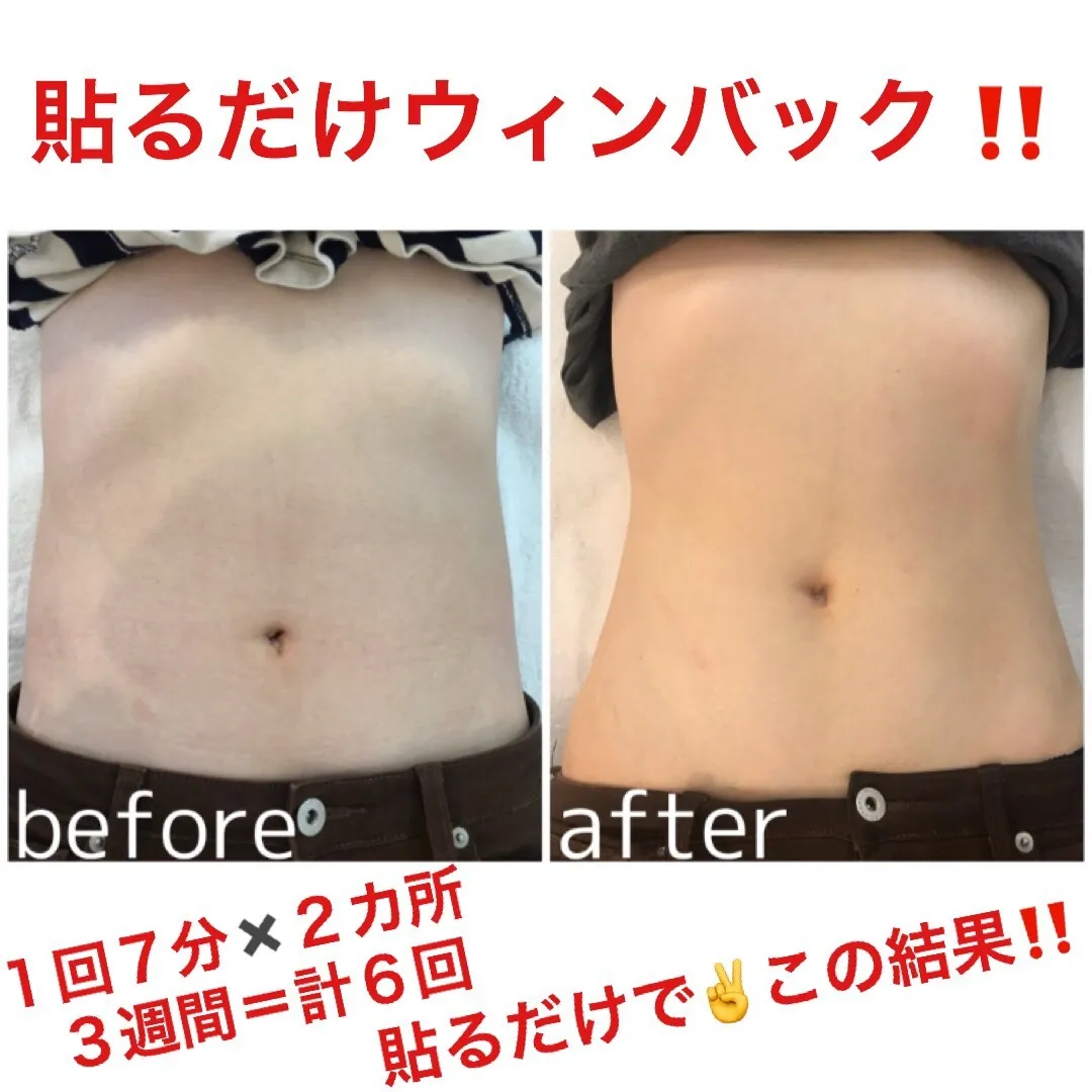 40代以降が痩せない理由とは？WINBACKで代謝を取り戻す