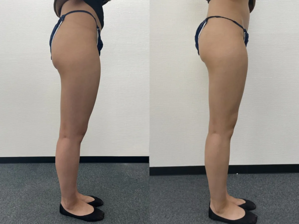 「内臓ケア痩身」という新しいダイエット